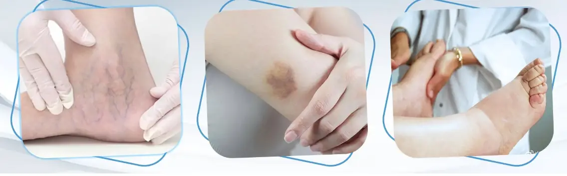 Application prospects of diosmetin