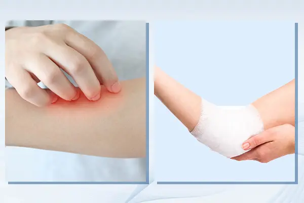 Tranexamic Acid