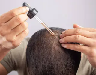Is Topical Minoxidil Safe?