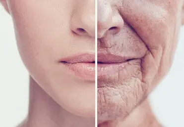 Can Fisetin Be Anti-Aging?