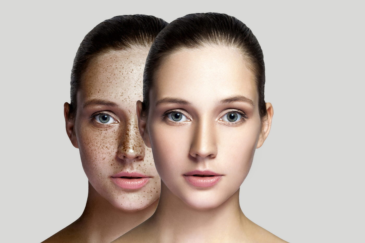 skin change