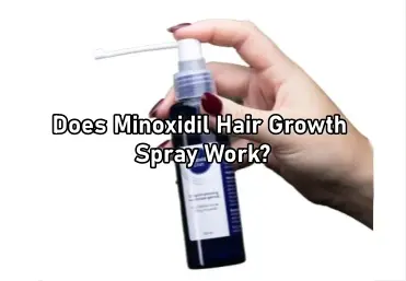 Does Minoxidil Hair Growth Spray Work?