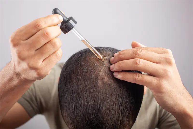 Minoxidil for hair