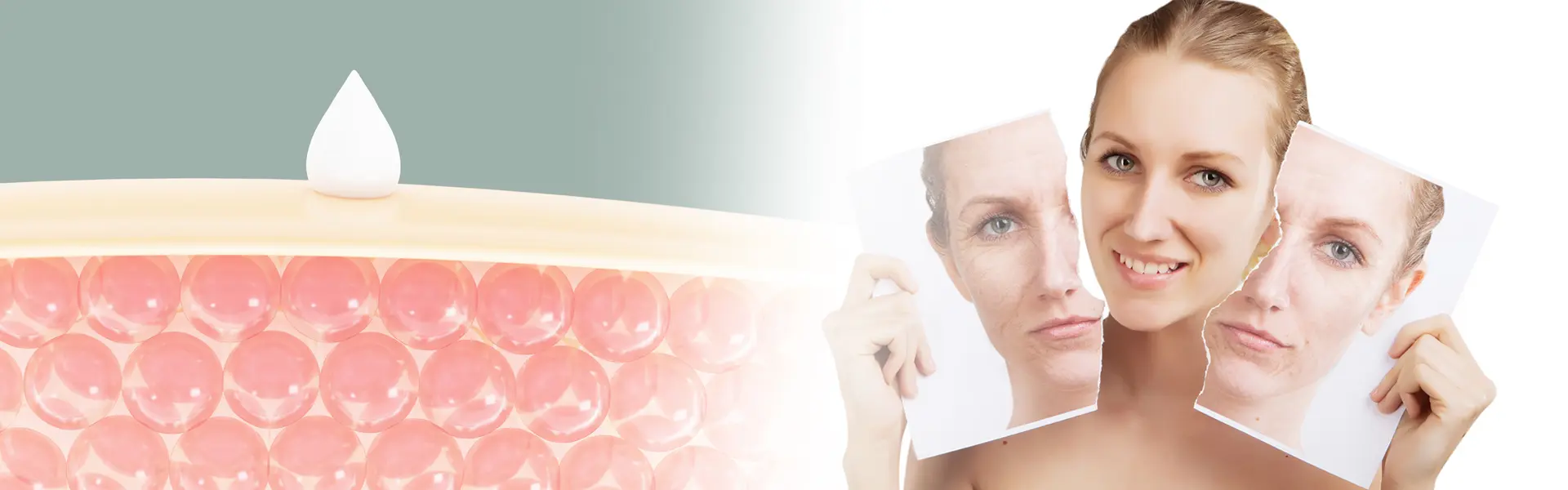 Hyaluronic Acid 99