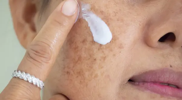 Tranexamic Acid for skin