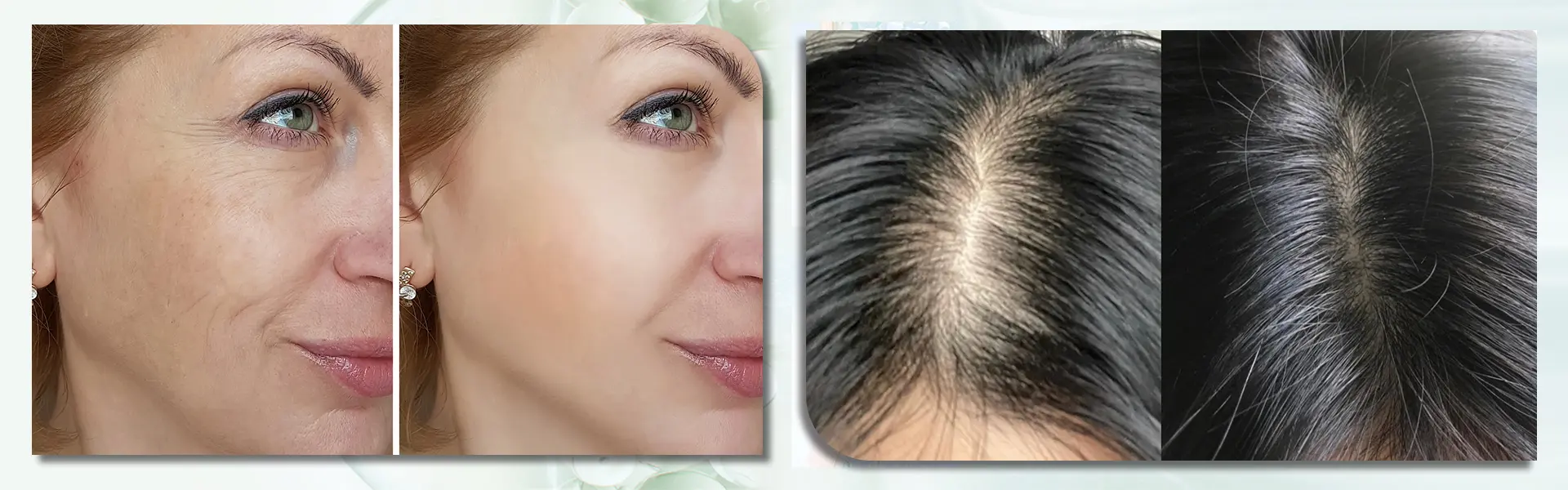 hair and face skin